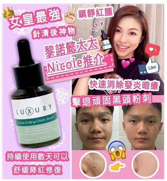 The Queen of Luxury Miracle Acne Water Dissolves Stubborn Blackheads Acne Muscle Pores Anti-Acne Shrinks Acne